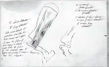 (Untitled) (Anatomical Study Of Bones), 1878. Creator: Thomas Eakins