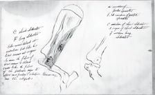 (Untitled) (Anatomical Study Of Bones), 1878. Creator: Thomas Eakins