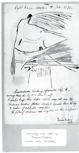 (Untitled) (Anatomical Study Of Right Knee), 1878. Creator: Thomas Eakins.