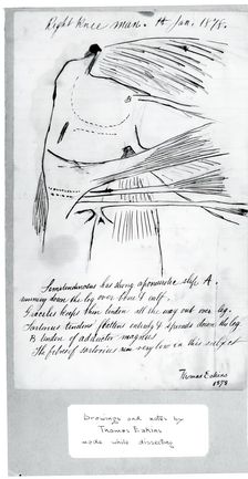 (Untitled) (Anatomical Study Of Right Knee), 1878. Creator: Thomas Eakins