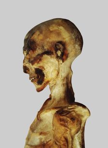 Unwrapped mummy head
