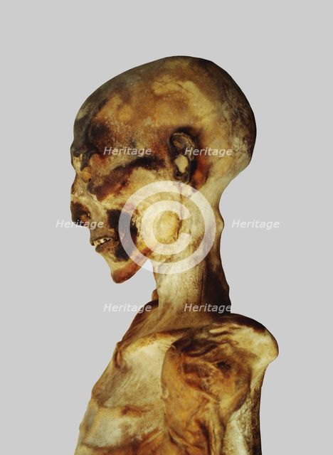 Unwrapped mummy head.