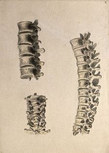 Vertebrae: three figures, 1830-1835. Creator: Unknown