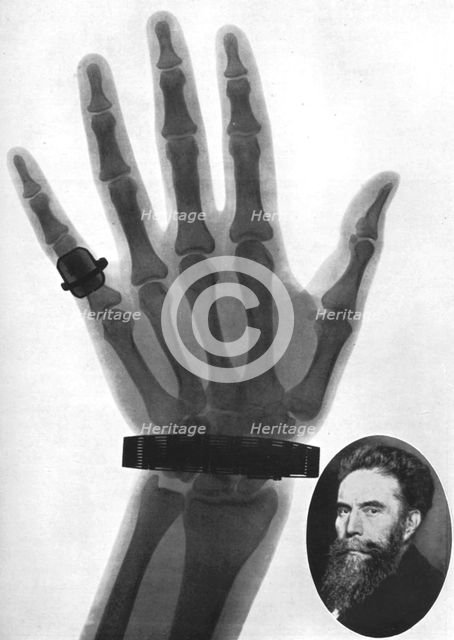 X-ray photograph of a hand, 1926. Artist: Unknown