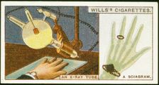 X-raying the hand, 1924. Creator: Unknown