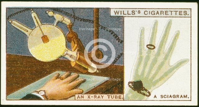 X-raying the hand, 1924. Creator: Unknown.